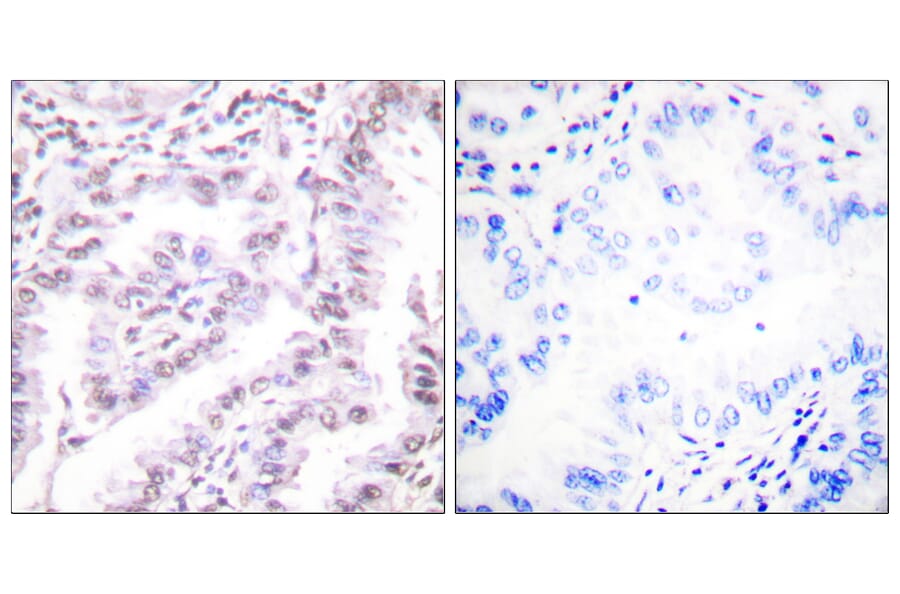 Immunohistochemistry - Anti-Ku80 Antibody (B0450) - Antibodies.com
