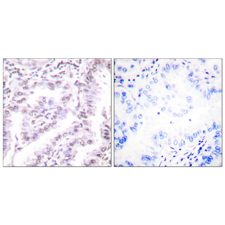 Immunohistochemistry - Anti-Ku80 Antibody (B0450) - Antibodies.com