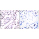 Immunohistochemistry - Anti-Ku80 Antibody (B0450) - Antibodies.com