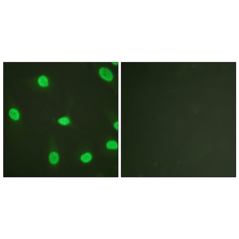 Immunofluorescence - Anti-Ku80 Antibody (B0450) - Antibodies.com