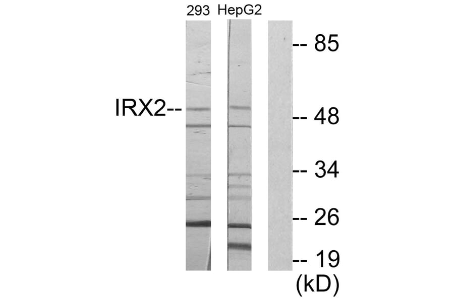 Western Blot - Anti-IRX2 Antibody (C11651) - Antibodies.com