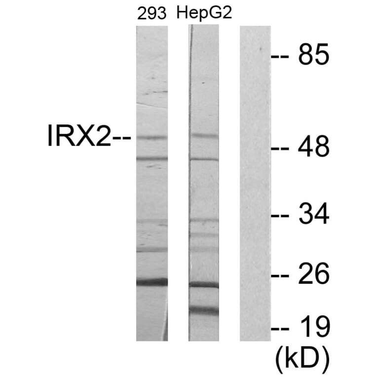 Western Blot - Anti-IRX2 Antibody (C11651) - Antibodies.com