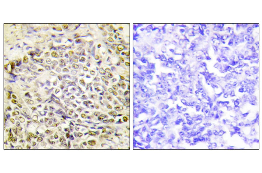 Immunohistochemistry - Anti-IRX2 Antibody (C11651) - Antibodies.com