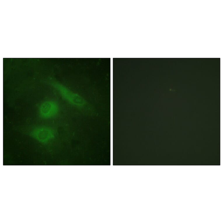 Immunofluorescence - Anti-IRF3 Antibody (B0496) - Antibodies.com