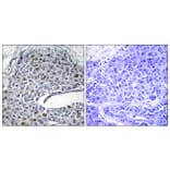 Immunohistochemistry - Anti-IRF3 Antibody (B0496) - Antibodies.com