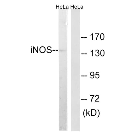 Western Blot - Anti-iNOS Antibody (C0251) - Antibodies.com