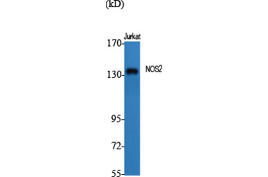 Western Blot - Anti-iNOS Antibody (C0251) - Antibodies.com
