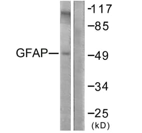 Western Blot - Anti-GFAP Antibody (B1205) - Antibodies.com
