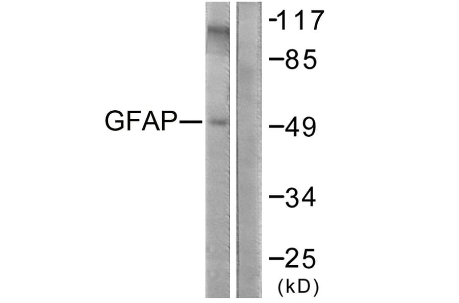 Western Blot - Anti-GFAP Antibody (B1205) - Antibodies.com