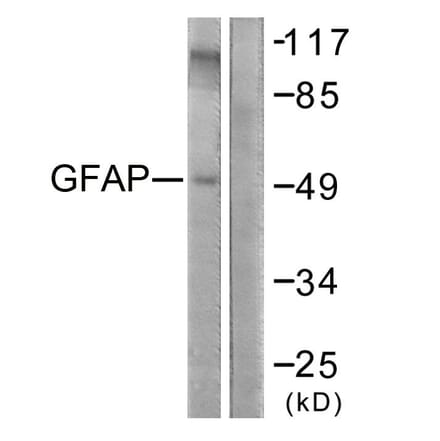 Western Blot - Anti-GFAP Antibody (B1205) - Antibodies.com