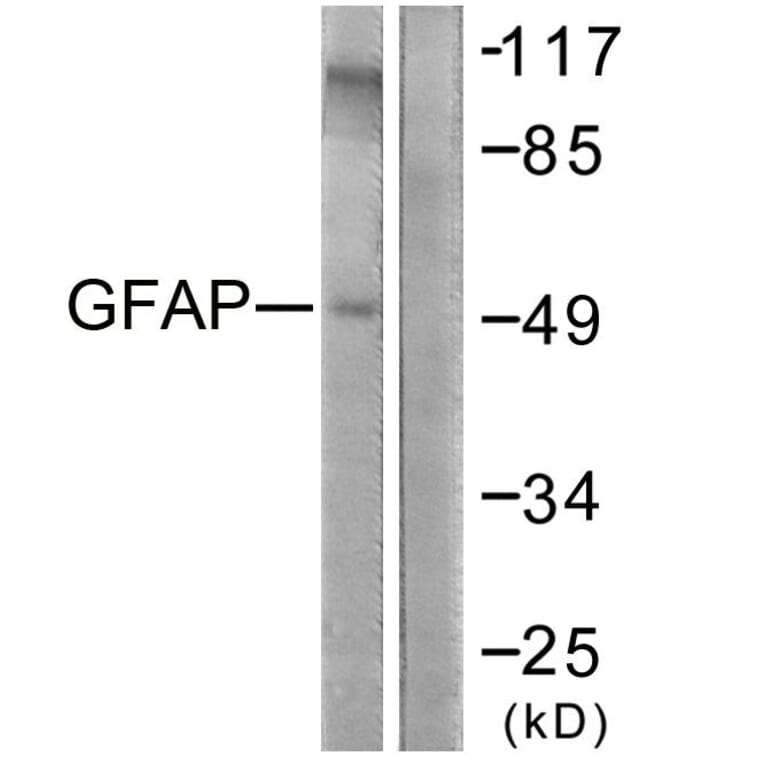 Western Blot - Anti-GFAP Antibody (B1205) - Antibodies.com