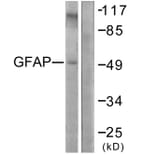 Western Blot - Anti-GFAP Antibody (B1205) - Antibodies.com