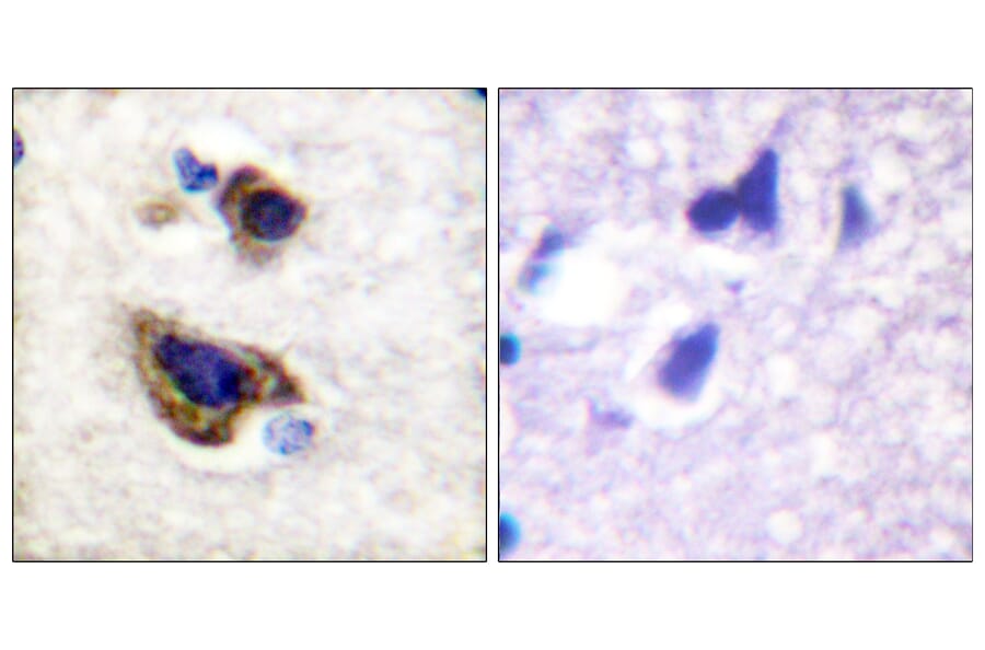 Immunohistochemistry - Anti-GFAP Antibody (B1205) - Antibodies.com