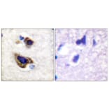 Immunohistochemistry - Anti-GFAP Antibody (B1205) - Antibodies.com