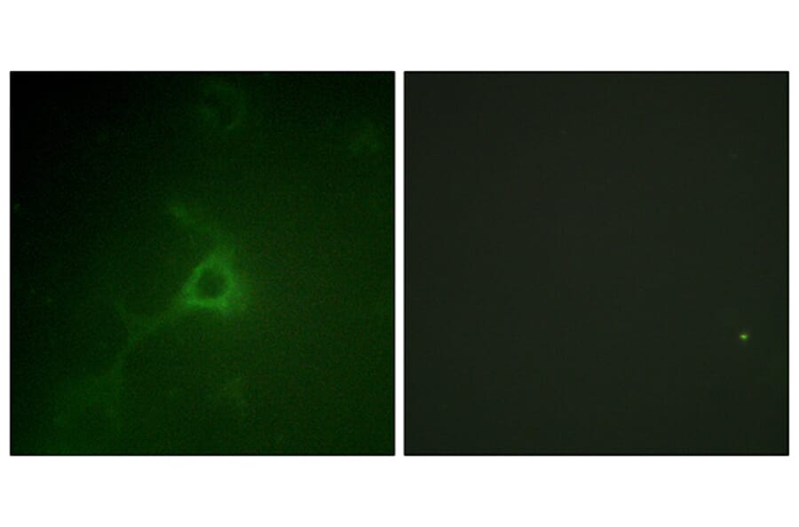 Immunofluorescence - Anti-GFAP Antibody (B1205) - Antibodies.com