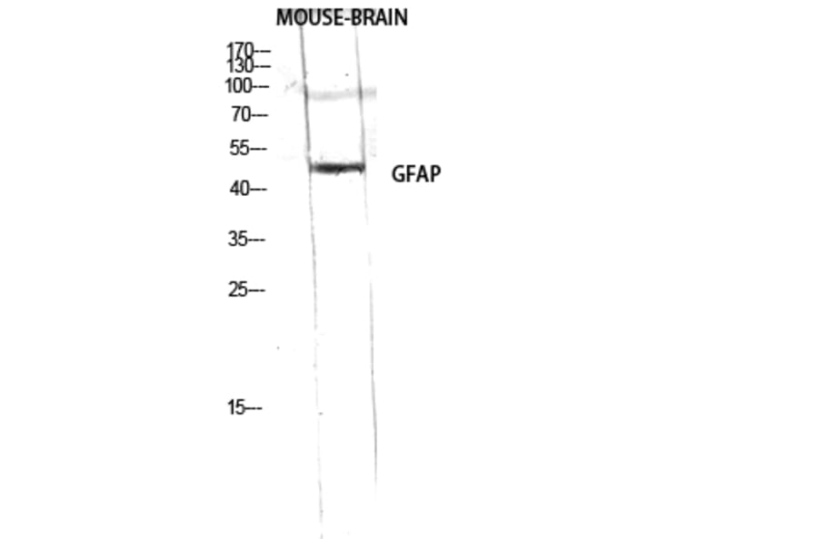 Western Blot - Anti-GFAP Antibody (B1205) - Antibodies.com