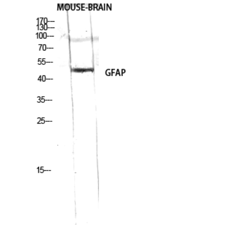 Western Blot - Anti-GFAP Antibody (B1205) - Antibodies.com