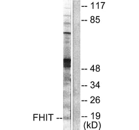 Western Blot - Anti-FHIT Antibody (C0193) - Antibodies.com