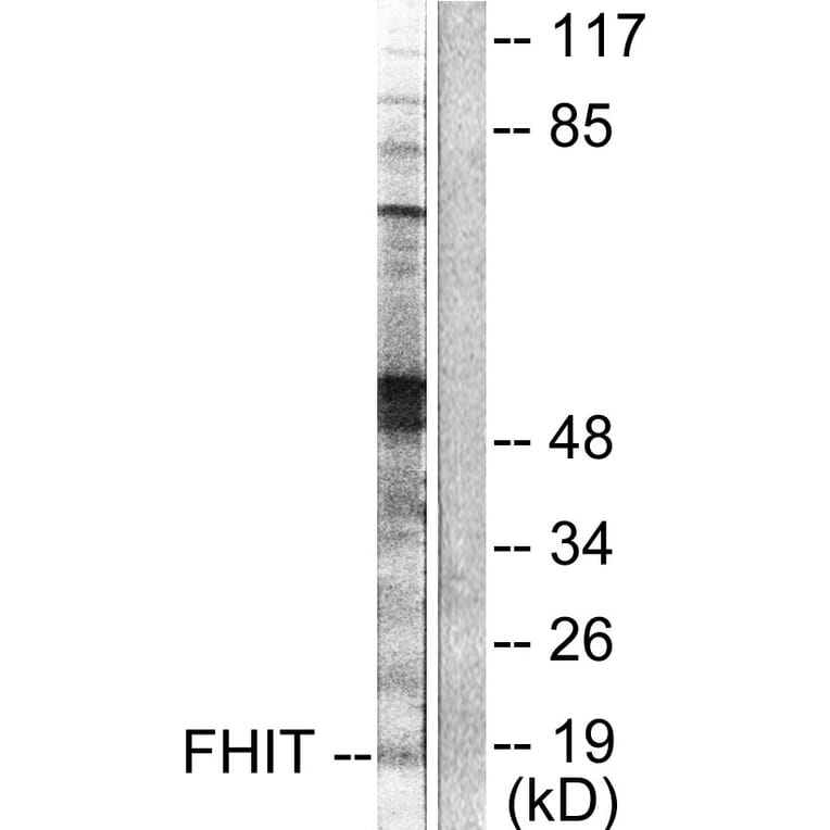 Western Blot - Anti-FHIT Antibody (C0193) - Antibodies.com