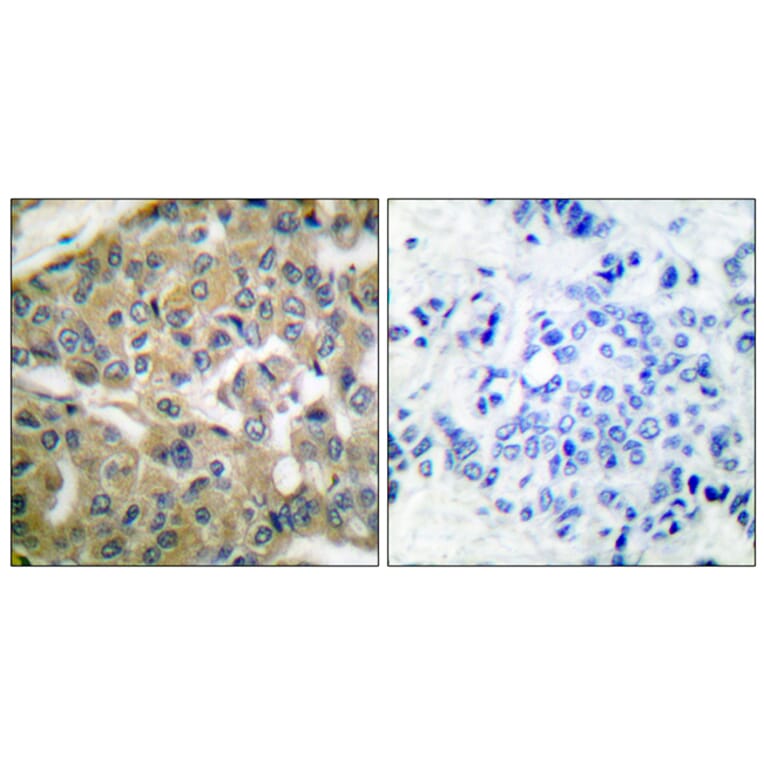 Immunohistochemistry - Anti-FHIT Antibody (C0193) - Antibodies.com