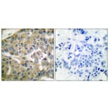 Immunohistochemistry - Anti-FHIT Antibody (C0193) - Antibodies.com