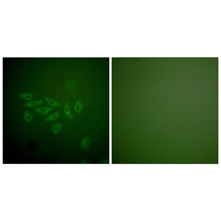 Immunofluorescence - Anti-FHIT Antibody (C0193) - Antibodies.com