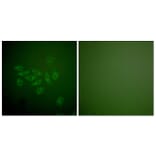 Immunofluorescence - Anti-FHIT Antibody (C0193) - Antibodies.com