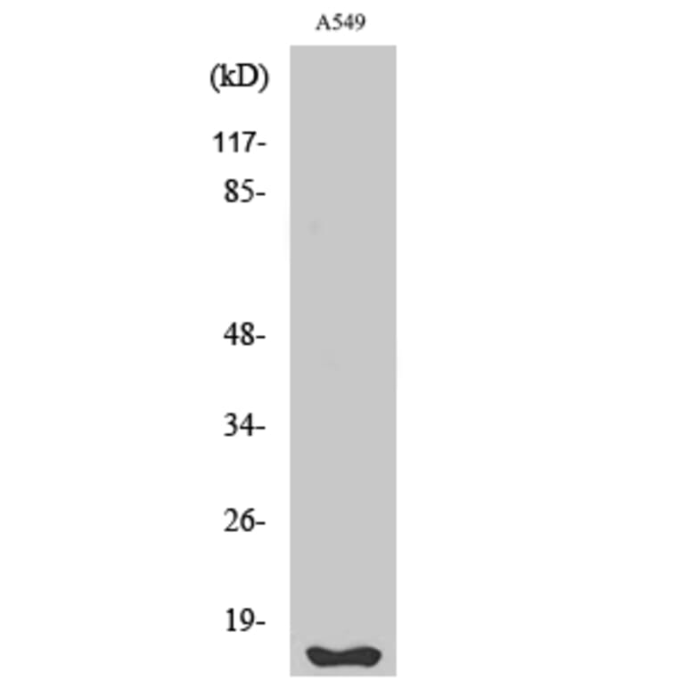 Western Blot - Anti-FHIT Antibody (C0193) - Antibodies.com