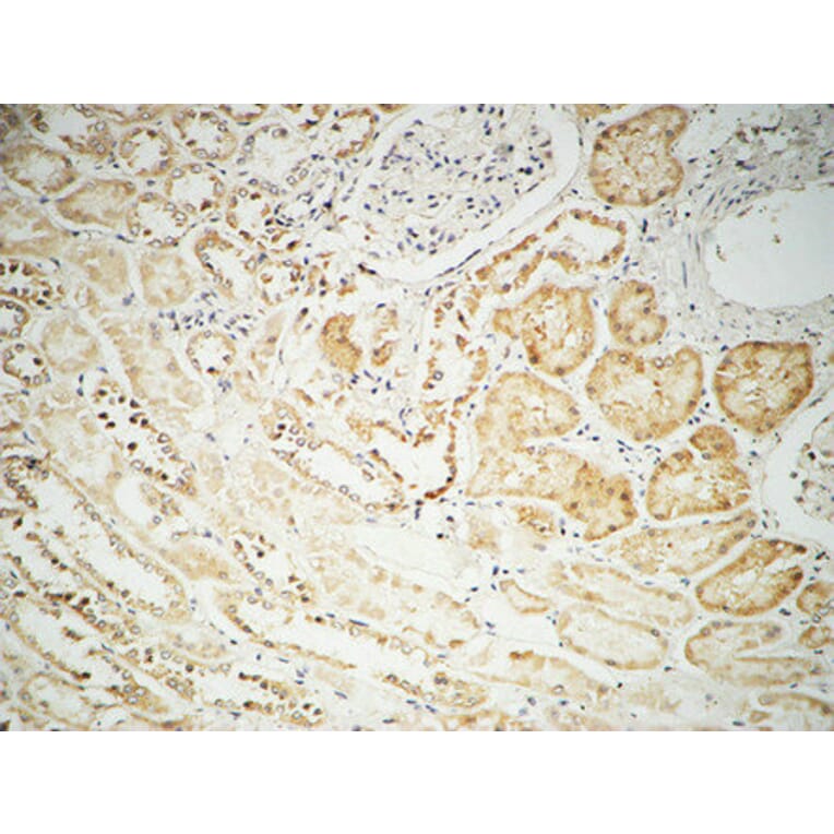 Immunohistochemistry - Anti-FHIT Antibody (C0193) - Antibodies.com