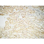 Immunohistochemistry - Anti-FHIT Antibody (C0193) - Antibodies.com