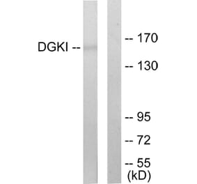 Western Blot - Anti-DGKI Antibody (C10197) - Antibodies.com