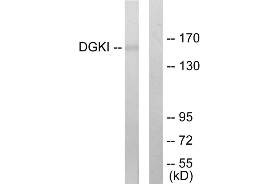 Western Blot - Anti-DGKI Antibody (C10197) - Antibodies.com