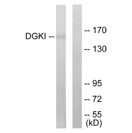 Western Blot - Anti-DGKI Antibody (C10197) - Antibodies.com