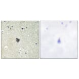 Immunohistochemistry - Anti-CSFR Antibody (B0876) - Antibodies.com