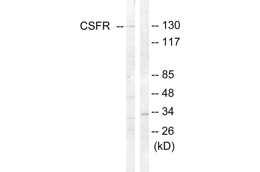 Western Blot - Anti-CSFR Antibody (B0876) - Antibodies.com