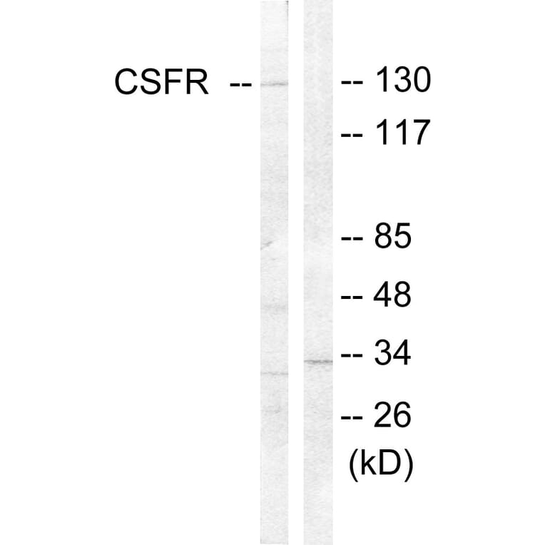 Western Blot - Anti-CSFR Antibody (B0876) - Antibodies.com