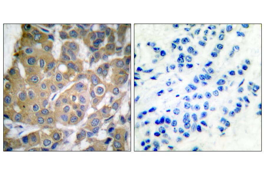 Immunohistochemistry - Anti-Cox2 Antibody (C0160) - Antibodies.com