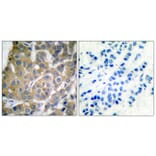 Immunohistochemistry - Anti-Cox2 Antibody (C0160) - Antibodies.com