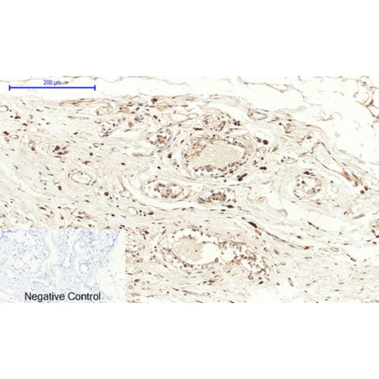 Immunohistochemistry - Anti-Cox2 Antibody (C0160) - Antibodies.com