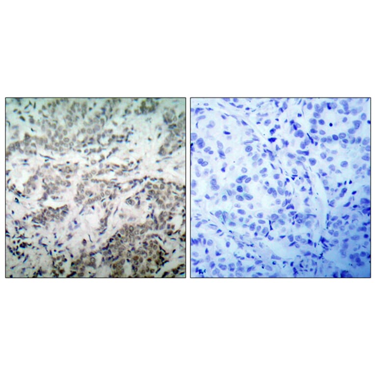 Immunohistochemistry - Anti-p53 Antibody (B7180) - Antibodies.com
