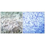 Immunohistochemistry - Anti-p53 Antibody (B7180) - Antibodies.com