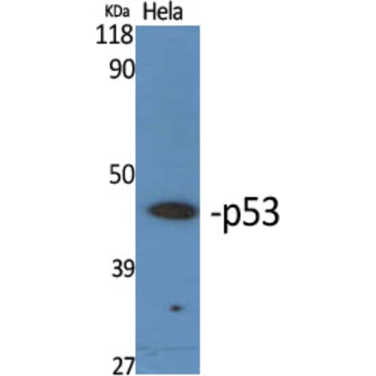 Western Blot - Anti-p53 Antibody (B7180) - Antibodies.com