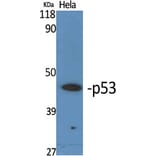 Western Blot - Anti-p53 Antibody (B7180) - Antibodies.com