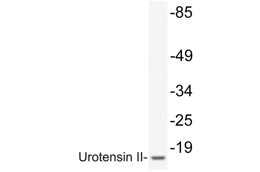 Western Blot - Anti-Urotensin II Antibody (R12-2404) - Antibodies.com