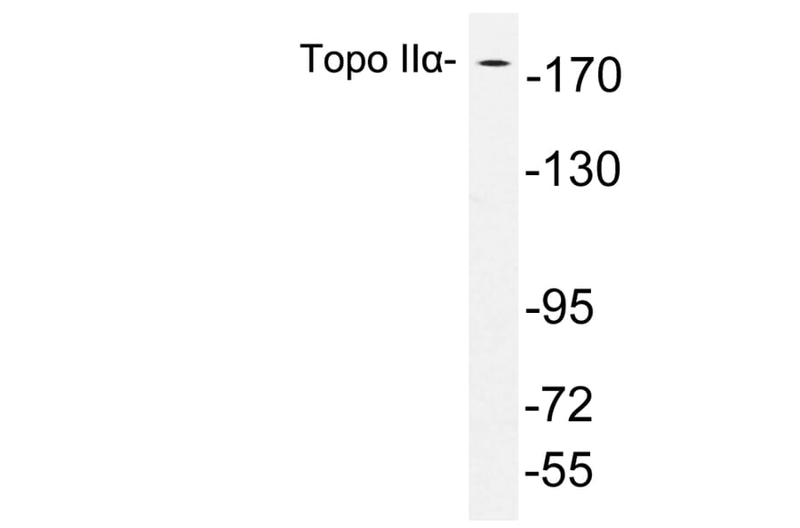 Western Blot - Anti-Topo IIalpha Antibody (R12-2383) - Antibodies.com