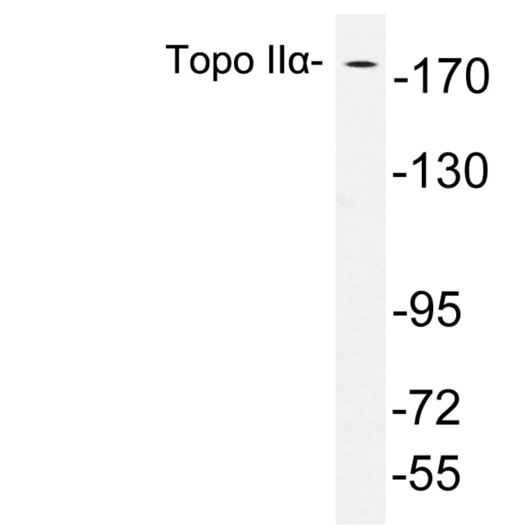 Western Blot - Anti-Topo IIalpha Antibody (R12-2383) - Antibodies.com