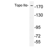 Western Blot - Anti-Topo IIalpha Antibody (R12-2383) - Antibodies.com