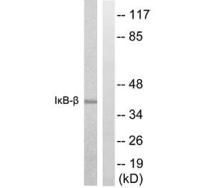 Western Blot - Anti-IkappaB-beta Antibody (B0438) - Antibodies.com