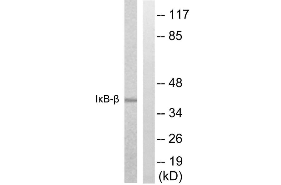 Western Blot - Anti-IkappaB-beta Antibody (B0438) - Antibodies.com