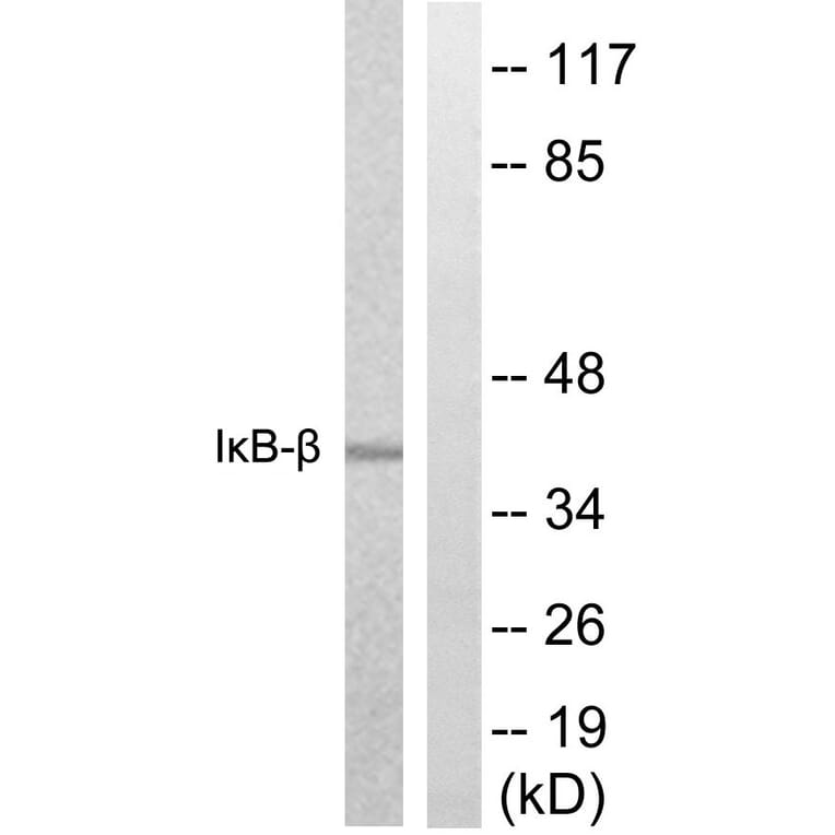 Western Blot - Anti-IkappaB-beta Antibody (B0438) - Antibodies.com